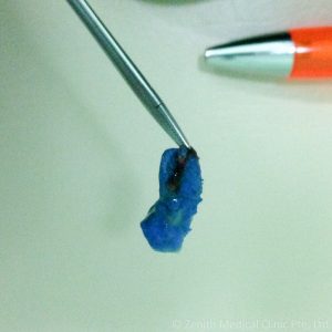 nose_blue_thing