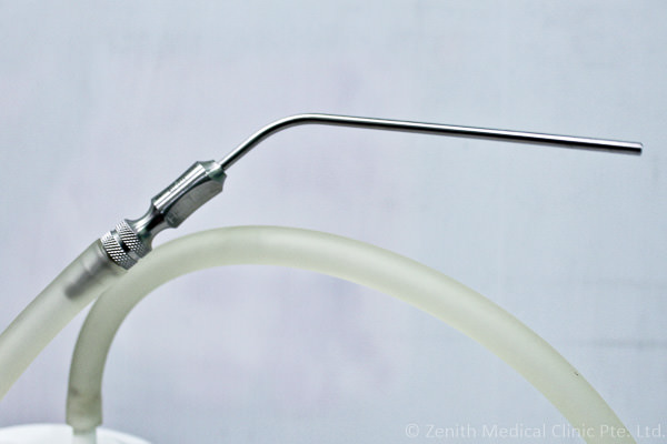Ear Microsuction