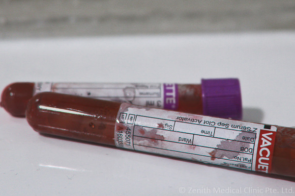 blood-tubes