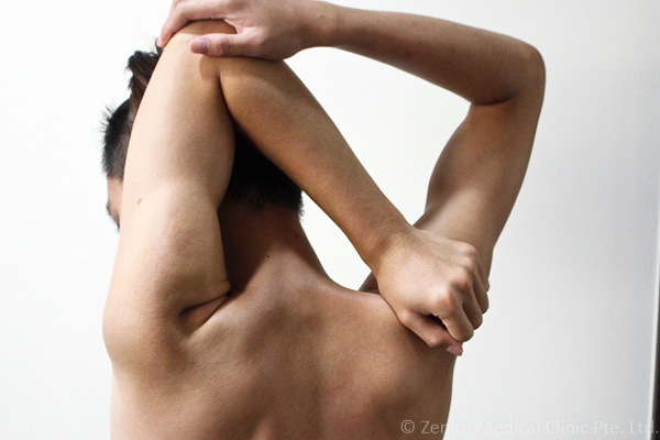 joint-pains