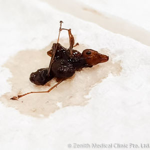 Ant removed from the ear, ouch the teeth looks sharp