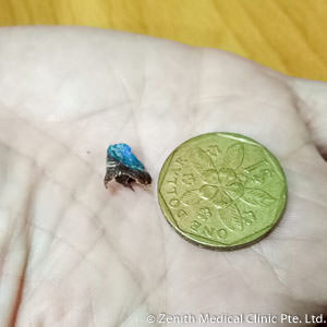 Some blue thing from the ears