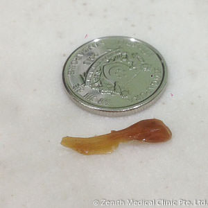 Some brown thing from the ears
